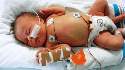 World Prematurity Day